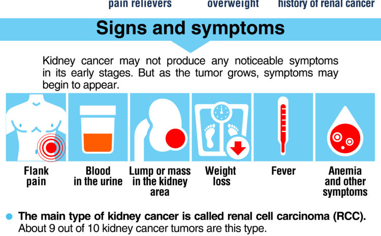  Renal Cancer
