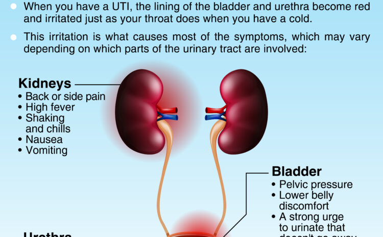  Urinary Tract Infections (UTIs)